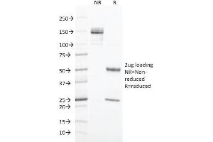SDS-PAGE Analysis Purified Cytokeratin 20 Mouse Monoclonal Antibody (SPM191). (KRT20 antibody  (AA 196-323))