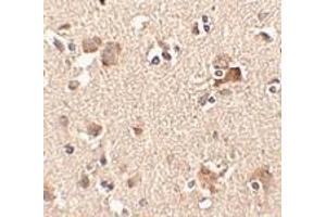 Immunohistochemistry of Aipl1 in human brain tissue with Aipl1 antibody at 2. (AIPL1 antibody  (Center))