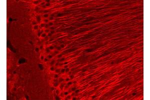 Immunohistochemistry (IHC) image for anti-Glu-alpha-Tubulin (C-Term) antibody (ABIN1742545) (Glu-alpha-Tubulin (C-Term) antibody)