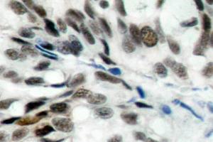 Image no. 1 for anti-Retinoblastoma 1 (RB1) antibody (ABIN271801) (Retinoblastoma 1 antibody)