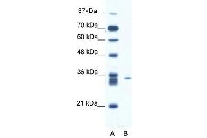 SIAH1 antibody (20R-1085) used at 0. (SIAH1 antibody  (N-Term))