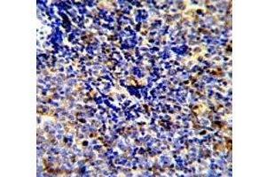 IHC analysis of FFPE human lymphoma stained with MERTK antibody
