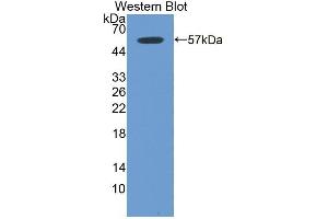 Detection of Recombinant ITGb6, Mouse using Polyclonal Antibody to Integrin Beta 6 (ITGb6) (ITGB6 antibody  (AA 131-619))