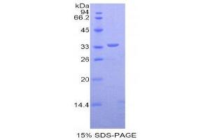 SDS-PAGE (SDS) image for Dystrophin (DMD) (AA 3048-3328) protein (His tag) (ABIN2120972)