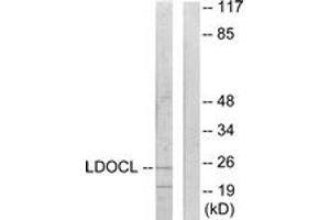 Western blot analysis of extracts from COLO205 cells, using LDOC1L Antibody. (LDOC1L antibody  (AA 141-190))