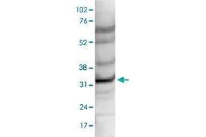 Nuclear extracts of HeLa cells (40 ug) were analysed by Western blot using CCDC101 polyclonal antibody  diluted 1 : 1,000 in TBS-Tween containing 5% skimmed milk.