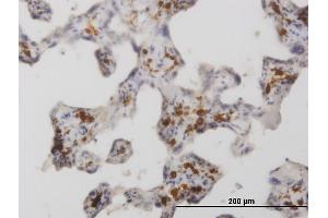 Immunoperoxidase of monoclonal antibody to MRC1 on formalin-fixed paraffin-embedded human placenta. (Macrophage Mannose Receptor 1 antibody  (AA 22-130))