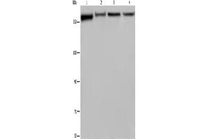 Western Blotting (WB) image for anti-Filamin A, alpha (FLNA) antibody (ABIN2423479) (Filamin A antibody)