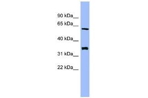 WB Suggested Anti-HECA Antibody Titration: 0. (HECA antibody  (Middle Region))