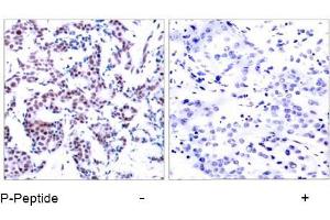Image no. 1 for anti-Jun B Proto-Oncogene (JUNB) (pSer259) antibody (ABIN196659) (JunB antibody  (pSer259))