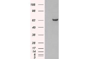 HEK293 overexpressing GRB7 and probed with ABIN2562933 (mock transfection in first lane). (GRB7 antibody  (N-Term))