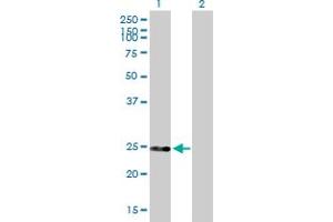 Western Blot analysis of DGCR6 expression in transfected 293T cell line by DGCR6 MaxPab polyclonal antibody. (DGCR6 antibody  (AA 1-220))