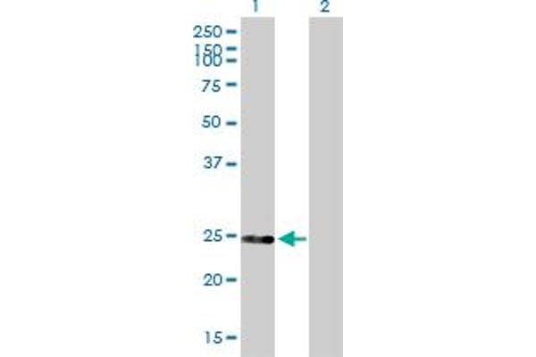 DGCR6 antibody  (AA 1-220)