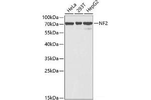 Western blot analysis of extracts of various cell lines using NF2 Polyclonal Antibody at dilution of 1:1000. (Merlin antibody)