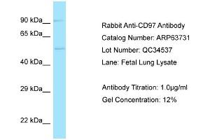 Western Blotting (WB) image for anti-CD97 (CD97) (C-Term) antibody (ABIN2789604)