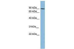 PRKCB1 antibody used at 1 ug/ml to detect target protein. (Pkc beta 1 antibody  (N-Term))