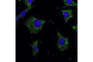 Immunofluorescence -anti-Rab7a Ab in Hepa1-6 cells at 1/50 dilution, cells were fixed With methanol, (RAB7A antibody  (C-Term))