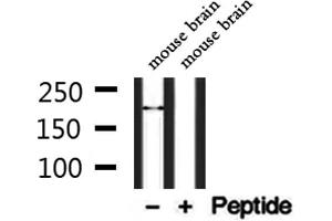 Western blot analysis of extracts from mouse brain, using TRPM2 Antibody. (TRPM2 antibody  (C-Term))