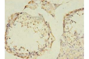 Immunohistochemistry of paraffin-embedded human testis tissue using ABIN7153493 at dilution of 1:100 (GABRB2 antibody  (AA 26-244))