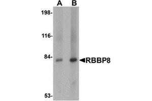 Western blot analysis of RBBP8 in mouse spleen tissue lysate with RBBP8 antibody at (A) 1 and (B) 2 μg/ml.