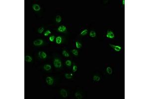 Immunofluorescence staining of Hela cells with ABIN7127714 at 1:100,counter-stained with DAPI. (Recombinant MTOR antibody  (pSer2448))