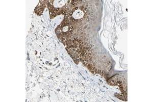 Immunohistochemical staining of human skin with FAM213A polyclonal antibody  shows strong cytoplasmic positivity in epidermal cells. (FAM213A antibody)
