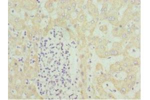 Immunohistochemistry of paraffin-embedded human liver tissue using ABIN7155995 at dilution of 1:100 (HMGCL antibody  (AA 1-325))