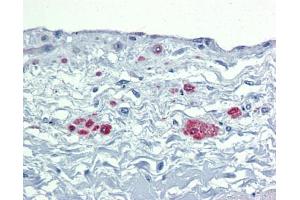 Immunohistochemistry (IHC) image for anti-SRY (Sex Determining Region Y)-Box 7 (SOX7) (Middle Region) antibody (ABIN2778378) (SOX7 antibody  (Middle Region))
