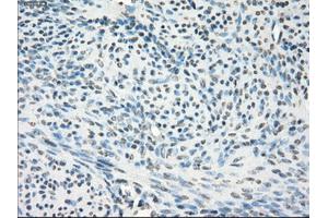 Immunohistochemical staining of paraffin-embedded pancreas tissue using anti-GBP2mouse monoclonal antibody. (GBP2 antibody)