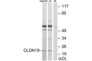 Western blot analysis of extracts fromHepG2 cells and Jurkat cells, using CLDN19 antibody. (Claudin 19 antibody  (Internal Region))