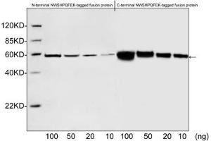 Western blot analysis of S-tagged fusion proteins expressed in E. (S-Tag antibody)