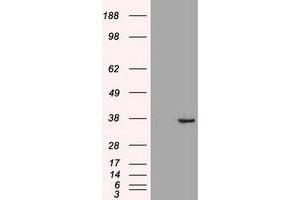 Western Blotting (WB) image for anti-Caudal Type Homeobox 2 (CDX2) (AA 1-313) antibody (ABIN2718448)