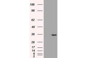 HEK293T cells were transfected with the pCMV6-ENTRY control (Left lane) or pCMV6-ENTRY CDX2 (Right lane) cDNA for 48 hrs and lysed. (CDX2 antibody  (AA 1-313))