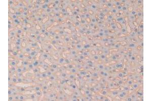 IHC-P analysis of Rat Liver Tissue, with DAB staining. (CD147 antibody  (AA 59-321))