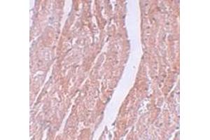 Immunohistochemistry (IHC) image for anti-MYC Induced Nuclear Antigen (MINA) (N-Term) antibody (ABIN1031457) (MINA antibody  (N-Term))