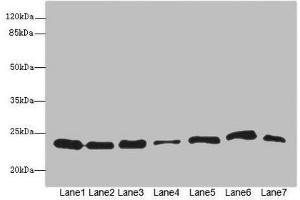 Western blot All lanes: PSMB3 antibody at 3.