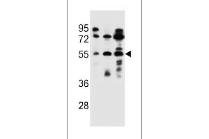 Western blot analysis in ZR-75-1,NCI-H292,293 cell line lysates (35ug/lane).