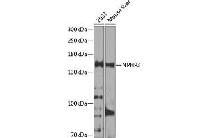 Western blot analysis of extracts of various cell lines, using NPHP3 antibody (ABIN6132967, ABIN6144770, ABIN6144771 and ABIN6224683) at 1:1000 dilution. (NPHP3 antibody  (AA 1-130))
