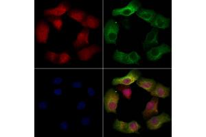 ABIN6257466 and ABIN6274772 staining Hela cells by IF/ICC. (RPL19 antibody  (C-Term))