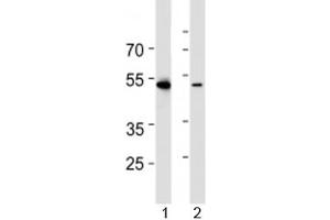 Western blot analysis of lysate from 1) HL-60 and 2) Jurkat cell line using RUNX3 antibody at 1:1000.