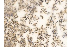 ABIN6262189 and ABIN6266560 at 1/100 staining human pituitary adenoma by IHC-P.
