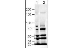 Western blot using  Affinity Purified anti-SLIT-1 antibody shows detection of SLIT-1 in rat (lane 1) and mouse (lane 2) brain lysates. (SLIT1 antibody  (AA 487-504))