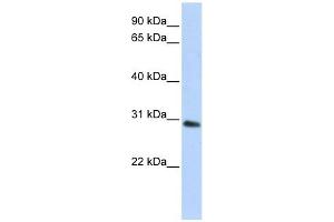 BPGM antibody used at 1 ug/ml to detect target protein. (BPGM antibody  (C-Term))