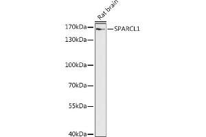 Western blot analysis of extracts of Rat brain, using SP antibody (ABIN7270512) at 1:1000 dilution. (SPARCL1 antibody  (AA 17-300))