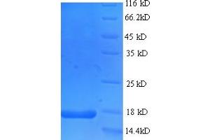 SDS-PAGE (SDS) image for Frataxin (FXN) (AA 78-207) protein (His-SUMO Tag) (ABIN4976732) (Frataxin Protein (FXN) (AA 78-207) (His-SUMO Tag))