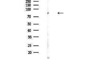 Western blot analysis of lysates from Rat lung, using BCAM Antibody at 1/1000 dilution.