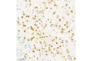 Immunofluorescence of paraffin embedded rat brain using SOX1 (ABIN7075712) at dilution of 1:1000 (300x lens) (SOX1 antibody)