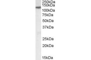 Western Blotting (WB) image for anti-Solute Carrier Family 12 (Potassium-Chloride Transporter) Member 6 (SLC12A6) (AA 375-386) antibody (ABIN962684)