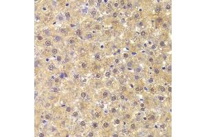 Immunohistochemistry (Paraffin-embedded Sections) (IHC (p)) image for anti-Acidic (Leucine-Rich) Nuclear phosphoprotein 32 Family, Member A (ANP32A) (AA 1-170) antibody (ABIN6136909)