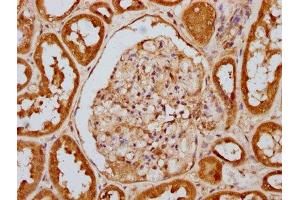 IHC image of ABIN7127689 diluted at 1:100 and staining in paraffin-embedded human kidney tissue performed on a Leica BondTM system. (Recombinant EIF2AK2 antibody  (pThr446))